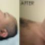 Cavi lipo . kroppsbehandling 30 min