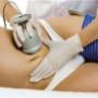 Cavi lipo . kroppsbehandling 30 min